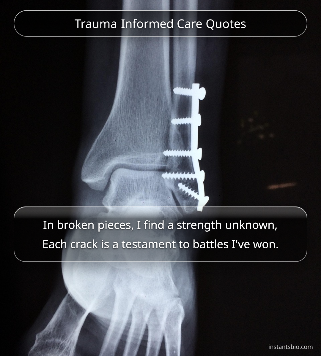Trauma Informed Care Quotes - trauma quotes